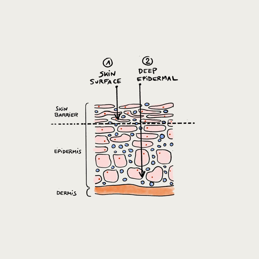Diagram of skin levels 